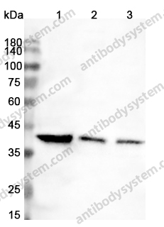 Anti-BCAT2 Polyclonal Antibody