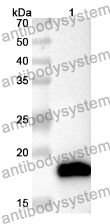 Anti-BIRC5 Polyclonal Antibody