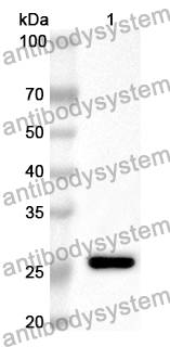 Anti-TMPRSS2 Polyclonal Antibody