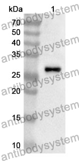 Anti-ABCC3 Polyclonal Antibody