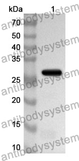 Anti-ABCC4 Polyclonal Antibody