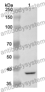 Anti-P4HA2 Polyclonal Antibody