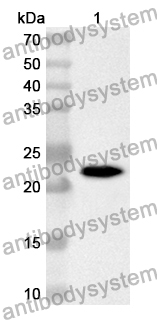 Anti-Human INSIG1 Polyclonal Antibody