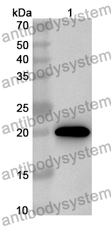 Anti-Human FLIP/CFLAR Polyclonal Antibody