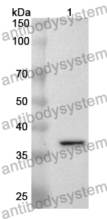 Anti-OGG1 Polyclonal Antibody