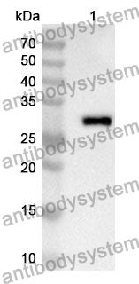 Anti-CYP27B1 Polyclonal Antibody