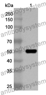 Anti-RS1 Polyclonal Antibody