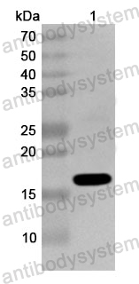 Anti-Human RGS5 Polyclonal Antibody