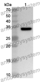 Anti-Human P2RX6 Polyclonal Antibody