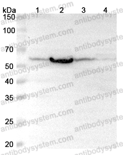 Anti-Human PHGDH Polyclonal Antibody