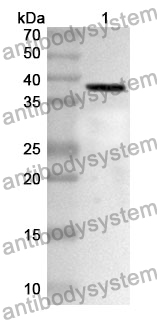 Anti-ADAM12 Polyclonal Antibody