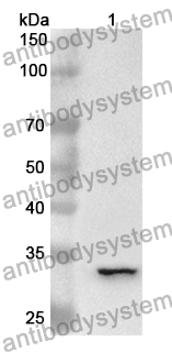 Anti-IRAK2 Polyclonal Antibody