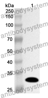 Anti-Human SIAH2 Polyclonal Antibody