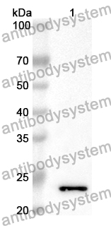 Anti-TREH Polyclonal Antibody