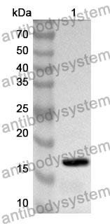 Anti-TGFB1I1 Polyclonal Antibody