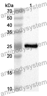 Anti-ADCY6 Polyclonal Antibody