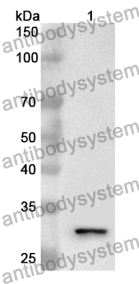 Anti-AQP9 Polyclonal Antibody