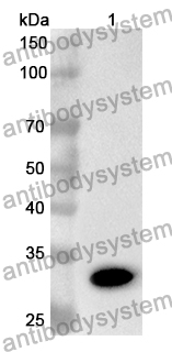 Anti-MAP3K7 Polyclonal Antibody