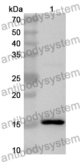 Anti-Human HNRNPR Polyclonal Antibody