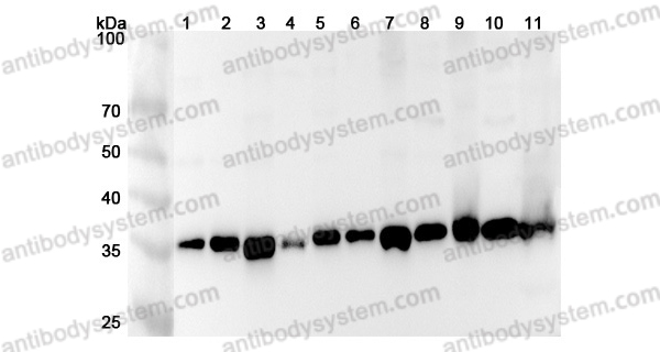 Anti-Human TXNL1 Polyclonal Antibody