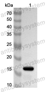 Anti-Human TPD52L2 Polyclonal Antibody