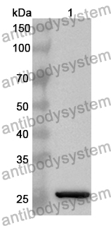 Anti-FIBP Polyclonal Antibody