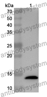 Anti-Human OIP5 Polyclonal Antibody