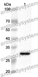 Anti-ADAM20 Polyclonal Antibody