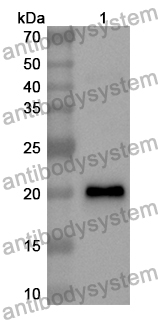 Anti-Human CD258/TNFSF14/LIGHT Polyclonal Antibody