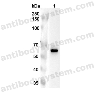 Anti-Human RGS14 Polyclonal Antibody