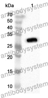 Anti-CA12 Polyclonal Antibody