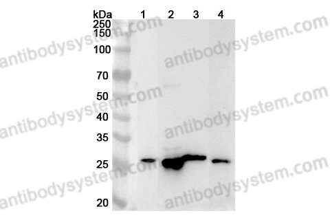 Anti-Human DENR Polyclonal Antibody