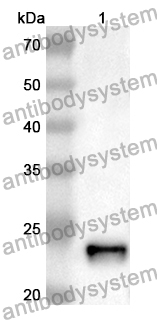 Anti-SPRY2 Polyclonal Antibody