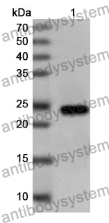 Anti-Human DCX Polyclonal Antibody