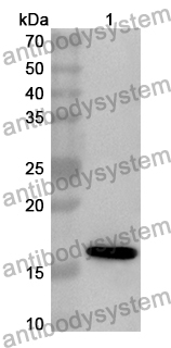 Anti-Human HCRTR1 Polyclonal Antibody