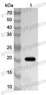 Anti-Human TRAPPC3 Polyclonal Antibody