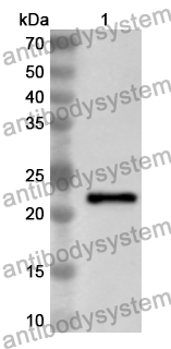 Anti-Human CHMP2A Polyclonal Antibody