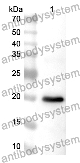 Anti-Human BUB1 Polyclonal Antibody