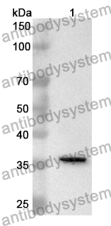 Anti-ACTN4 Polyclonal Antibody