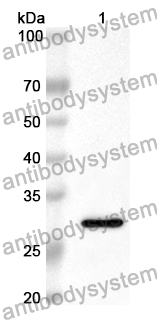 Anti-PRKAB2 Polyclonal Antibody