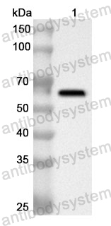 Anti-Human AP1G1 Polyclonal Antibody