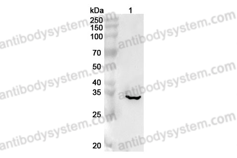 Anti-Human SGTA Polyclonal Antibody