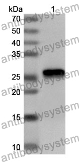 Anti-Human LIAS Polyclonal Antibody