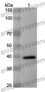 Anti-NARS1 Polyclonal Antibody