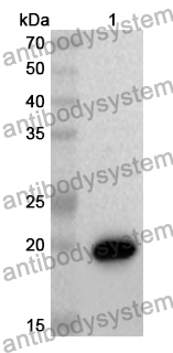 Anti-Human SPOP Polyclonal Antibody