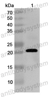 Anti-Human SSNA1 Polyclonal Antibody