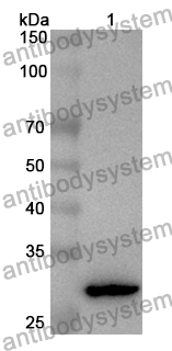 Anti-Human ANGPTL7 Polyclonal Antibody