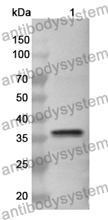 Anti-CALU Polyclonal Antibody