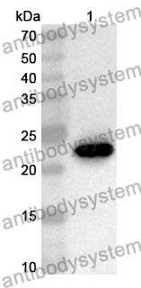 Anti-Human AIRE Polyclonal Antibody