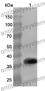 Anti-AKR1B10 Polyclonal Antibody